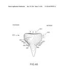 ARTHROPLASTY JIGS WITH MATING ACCURACY diagram and image