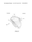 ARTHROPLASTY JIGS WITH MATING ACCURACY diagram and image