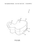 ARTHROPLASTY JIGS WITH MATING ACCURACY diagram and image