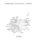 ARTHROPLASTY JIGS WITH MATING ACCURACY diagram and image