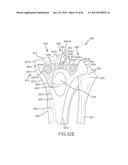 ARTHROPLASTY JIGS WITH MATING ACCURACY diagram and image