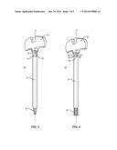 ANCHORED CANNULA diagram and image