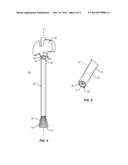 ANCHORED CANNULA diagram and image