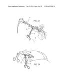 SUPPORT COUPLING FOR SURGICAL INSTRUMENT diagram and image