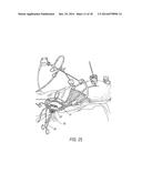 SUPPORT COUPLING FOR SURGICAL INSTRUMENT diagram and image