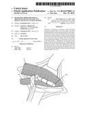 Monolithic Three-Dimensional Prosthesis for the Treatment of Hernias and     Manufacturing Method diagram and image