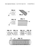 Graft Apparatus diagram and image