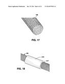 Graft Apparatus diagram and image