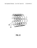 Graft Apparatus diagram and image