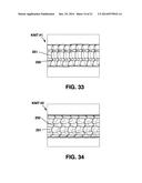 Graft Apparatus diagram and image