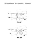 Graft Apparatus diagram and image