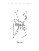 LEFT ATRIAL APPENDAGE OCCLUSIVE DEVICES diagram and image