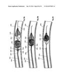 CLOT CAPTURE SYSTEMS AND ASSOCIATED METHODS diagram and image