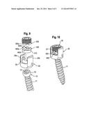 BONE ANCHORING DEVICE AND STABILIZATION DEVICE FOR BONE PARTS OR VERTEBRAE     COMPRISING SUCH A BONE ANCHORING DEVICE diagram and image