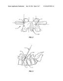 SPINAL IMPLANT SYSTEM AND METHOD diagram and image