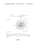 SPINAL IMPLANT SYSTEM AND METHOD diagram and image