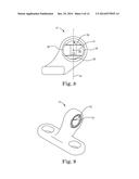 SPINAL CORRECTION AND SECONDARY STABILIZATION diagram and image