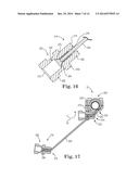 SPINAL CORRECTION AND SECONDARY STABILIZATION diagram and image