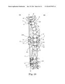 SPINAL CORRECTION AND SECONDARY STABILIZATION diagram and image