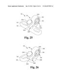 SPINAL CORRECTION AND SECONDARY STABILIZATION diagram and image