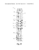 SPINAL CORRECTION AND SECONDARY STABILIZATION diagram and image