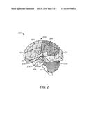 METHODS AND APPARATUS FOR TREATING GLIOMA diagram and image