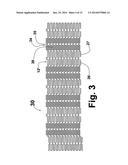 FLEXIBLE STENT diagram and image