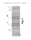 FLEXIBLE STENT diagram and image