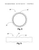 FLEXIBLE STENT diagram and image