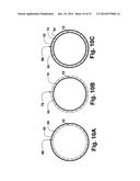 FLEXIBLE STENT diagram and image