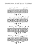 FLEXIBLE STENT diagram and image