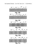 FLEXIBLE STENT diagram and image