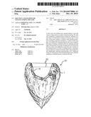 SKIN WEFT AND METHOD FOR MANUFACTURING THE SAME diagram and image