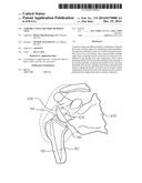 VARIABLE ANGLE REVERSE HUMERAL TRAY diagram and image