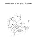 VARIABLE ANGLE REVERSE HUMERAL TRAY diagram and image