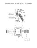 IN-VIVO CONDITION MONITORING OF METALLIC IMPLANTS BY ELECTROCHEMICAL     TECHNIQUES diagram and image