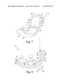 FEMORAL COMPONENT OF A KNEE PROSTHESIS HAVING AN ANGLED CEMENT POCKET diagram and image