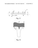 FEMORAL COMPONENT OF A KNEE PROSTHESIS HAVING AN ANGLED CEMENT POCKET diagram and image