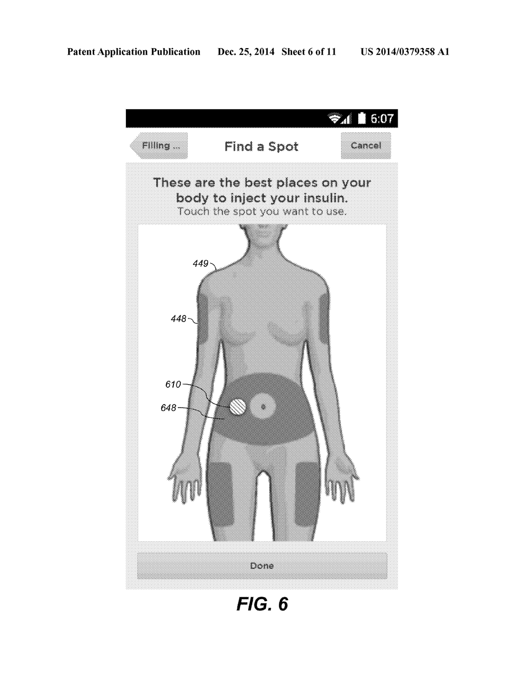 INSERTION-SITE DECISION-SUPPORT SYSTEMS AND METHODS - diagram, schematic, and image 07