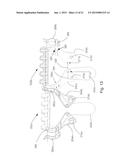 Waste Containment Receptacle diagram and image