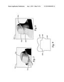 SYNCHRONIZED VIEWS OF VIDEO DATA AND THREE-DIMENSIONAL MODEL DATA diagram and image