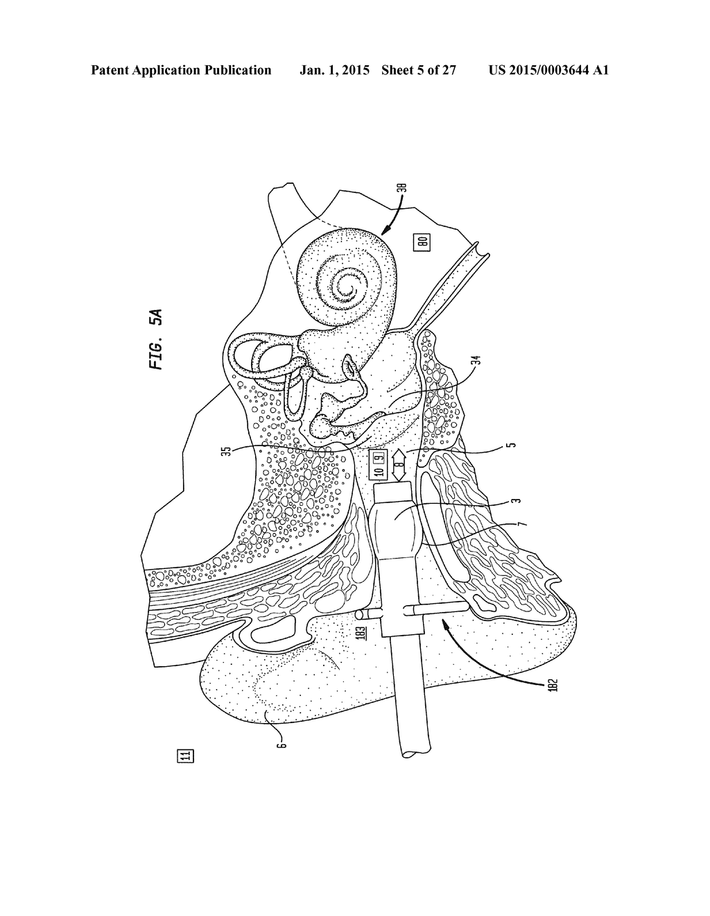 External Ear Canal Pressure Regulation System - diagram, schematic, and image 06