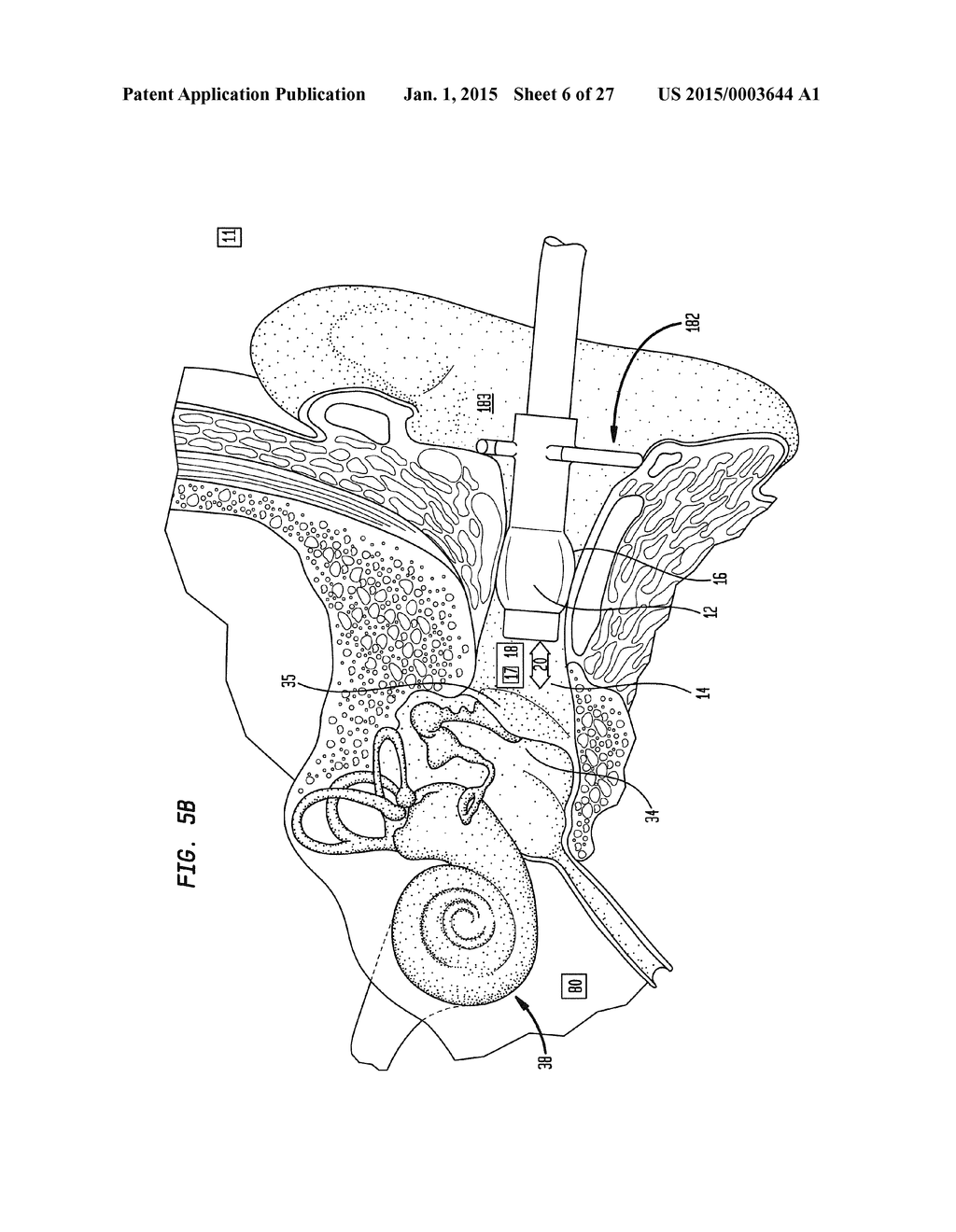 External Ear Canal Pressure Regulation System - diagram, schematic, and image 07