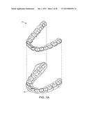 ORTHODONTIC REPOSITIONING APPLIANCES HAVING IMPROVED GEOMETRY, METHODS AND     SYSTEMS diagram and image