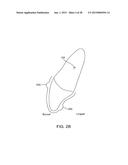 ORTHODONTIC REPOSITIONING APPLIANCES HAVING IMPROVED GEOMETRY, METHODS AND     SYSTEMS diagram and image