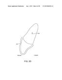 ORTHODONTIC REPOSITIONING APPLIANCES HAVING IMPROVED GEOMETRY, METHODS AND     SYSTEMS diagram and image