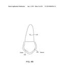 ORTHODONTIC REPOSITIONING APPLIANCES HAVING IMPROVED GEOMETRY, METHODS AND     SYSTEMS diagram and image