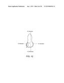 ORTHODONTIC REPOSITIONING APPLIANCES HAVING IMPROVED GEOMETRY, METHODS AND     SYSTEMS diagram and image