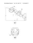 DENTAL ATTACHMENT APPLIANCE AND DEVICE diagram and image