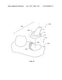 METHOD FOR MANIPULATING A DENTAL VIRTUAL MODEL, METHOD FOR     CREATINGPHYSICAL ENTITIES BASED ON A DENTAL VIRTUAL MODEL THUS     MANIPULATED, AND DENTAL MODELS THUS CREATED diagram and image